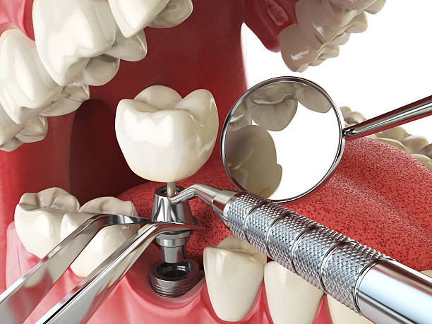 Best Cosmetic Emergency Dentistry in Stevenson Ranch, CA